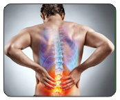 Lumbar Spondylosis